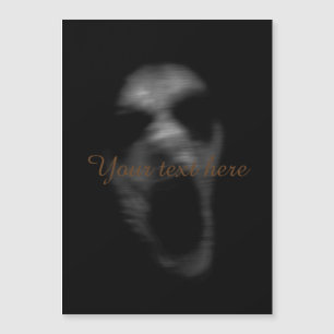 Falln Mentala störningar