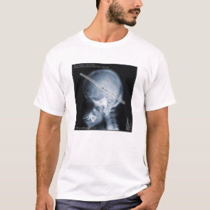 Fallstudie: Handelsresande Tee
