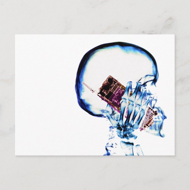 Färg X-Ray Vision Skeleton Skullcell Mobil Vykort (Framsida)