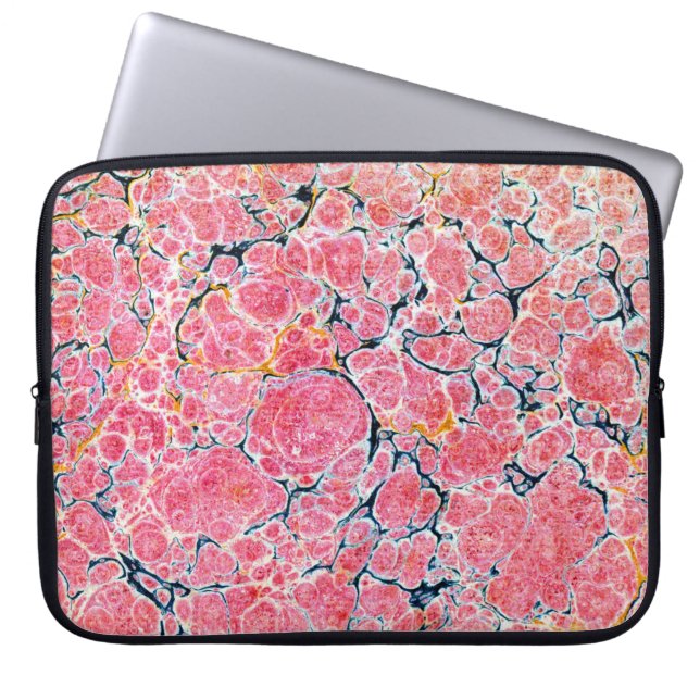 Färgglatt viktorianskt marmorerat pappersomslag laptop fodral (Framsidan)