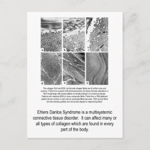 Faulty Collagen EDS Awareness Postcard Vykort