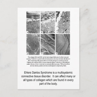 Faulty Collagen EDS Awareness Postcard Vykort