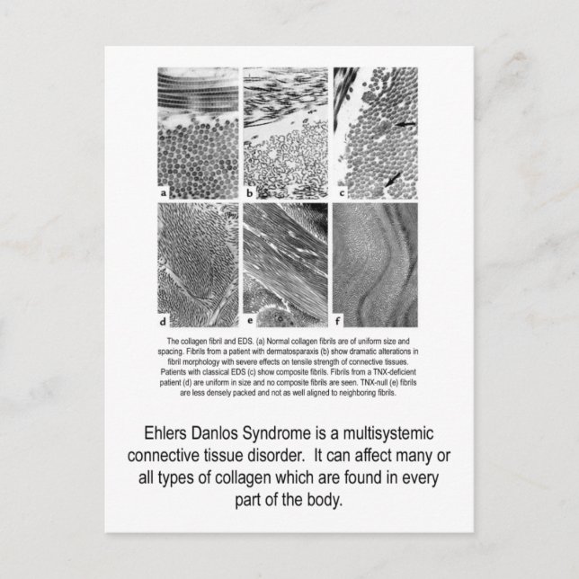 Faulty Collagen EDS Awareness Postcard Vykort (Framsida)