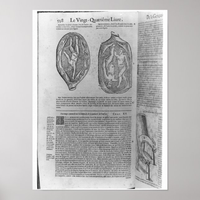 Fetus, illustration från Oeuvres Poster (Framsidan)