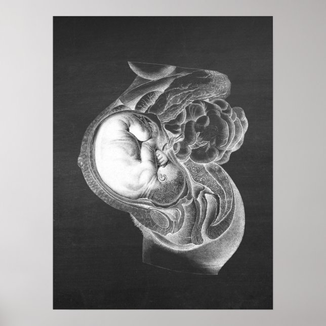 Fetus Womb Anatomy Obstetrics Decor no. 2 Poster (Framsidan)