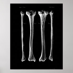 Fibula 1844 för Tibia för vintageanatomitryck Poster
