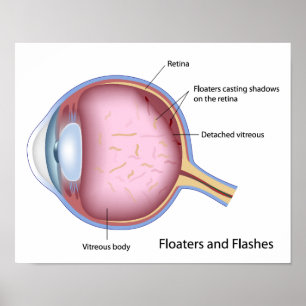 Flytande och flashbehandlade öga Poster