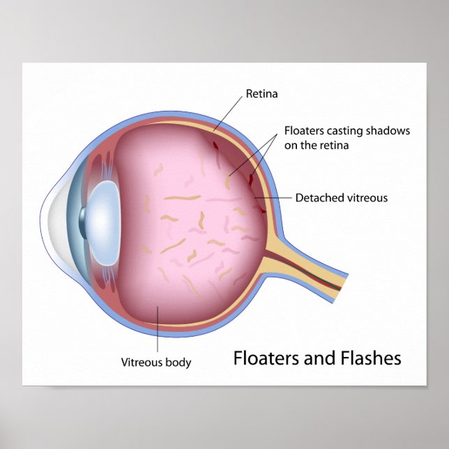 Flytande och flashbehandlade öga Poster (Framsidan)