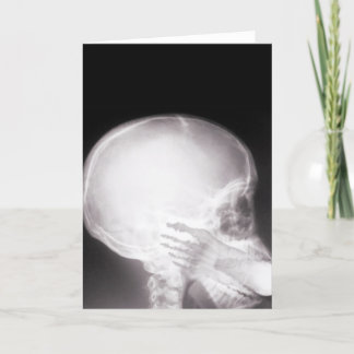 Foot i munnen X-Ray Kort