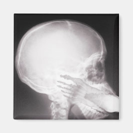 Foot i munnen X-Ray Magnet