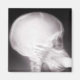 Foot i munnen X-Ray Magnet