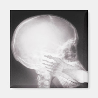 Foot i munnen X-Ray Magnet