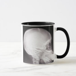 Foot i munnen X-Ray Mugg