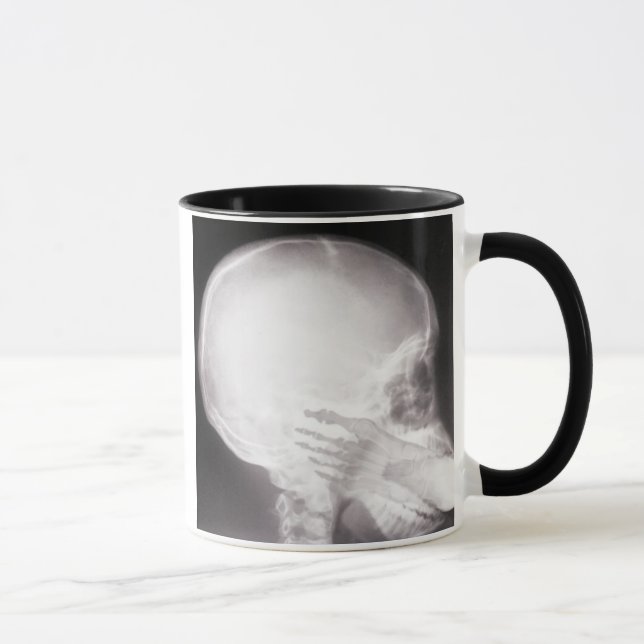 Foot i munnen X-Ray Mugg (Höger)