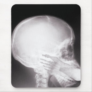 Foot i munnen X-Ray Musmatta