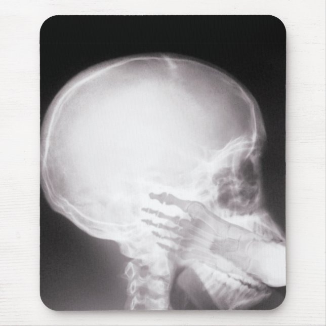 Foot i munnen X-Ray Musmatta (Framsidan)