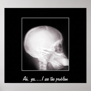 Foot i munnen X-Ray Poster