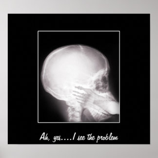 Foot i munnen X-Ray Poster