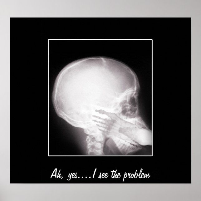 Foot i munnen X-Ray Poster (Framsidan)