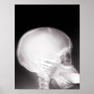 Foot i munnen X-Ray Poster