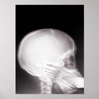Foot i munnen X-Ray Poster