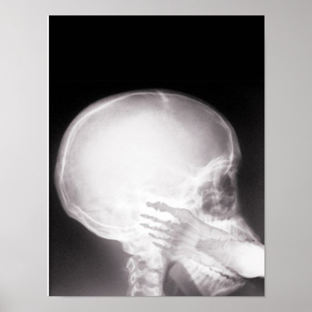 Foot i munnen X-Ray Poster (Framsidan)