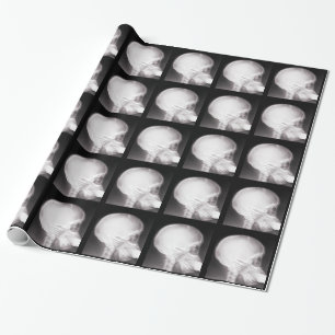 Foot i munnen X-Ray Presentpapper