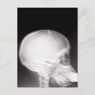 Foot i munnen X-Ray Vykort