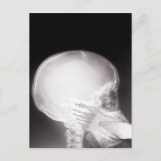 Foot i munnen X-Ray Vykort