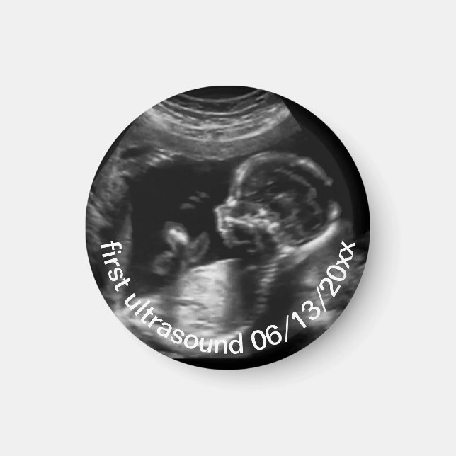 För New Mor First Ultrasound Sonogram Baby Magnet (Framsidan)
