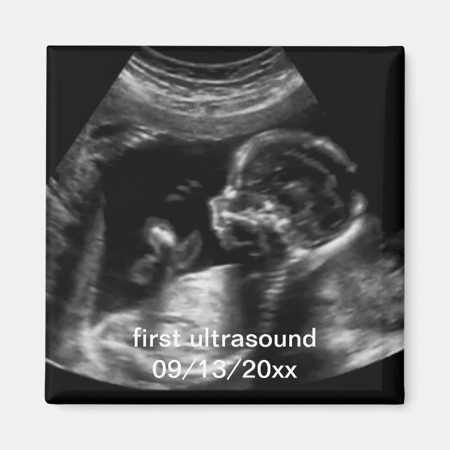 För New Mor First Ultrasound Sonogram Baby Magnet (Framsidan)