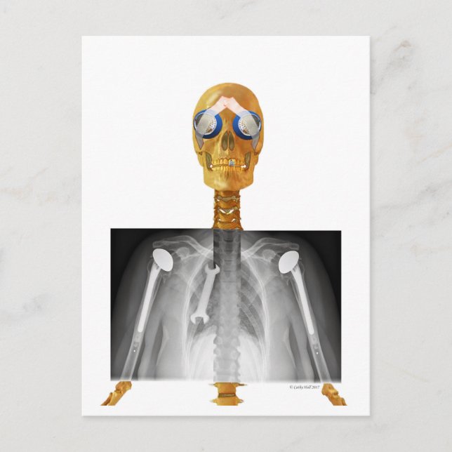 Föradresserat vykort till Trump re Trumpcare (Framsida)