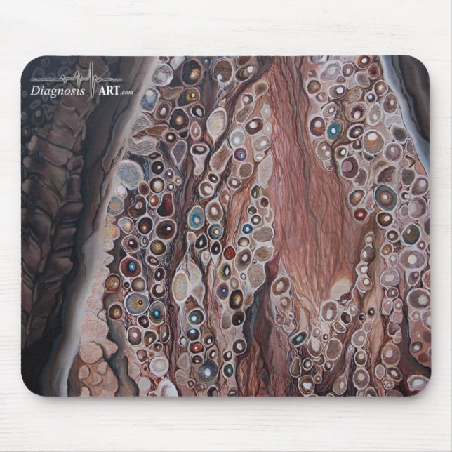 "Förnimmelse: Rygg- rota nervknuten ", Musmatta (Framsidan)