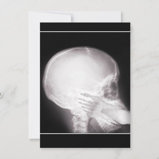 Förskrivning Inbjudan w/Foot in munröntgen (Framsida)