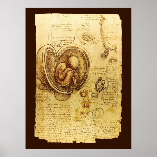 Foster av ett foster i livmodern,Ob-Gyn medicinsk Poster (Framsidan)