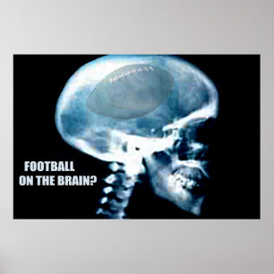 Fotbollshuvud (röntgen) poster