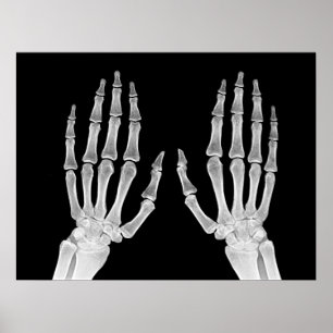 Foto på Skeleton Händer Xray Bild Human Anatomy Poster