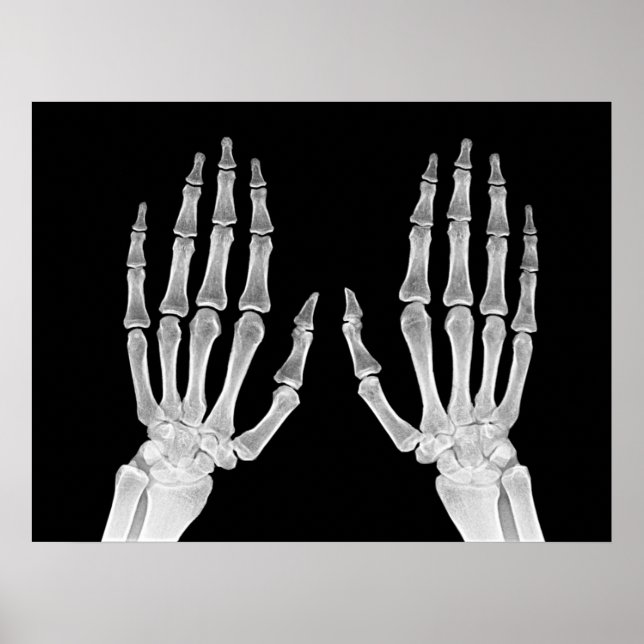 Foto på Skeleton Händer Xray Bild Human Anatomy Poster (Framsidan)