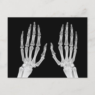 Foto på Skeleton Händer Xray Bild Human Anatomy Vykort