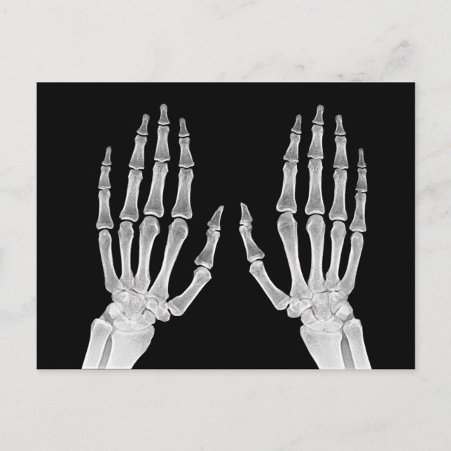 Foto på Skeleton Händer Xray Bild Human Anatomy Vykort (Framsida)