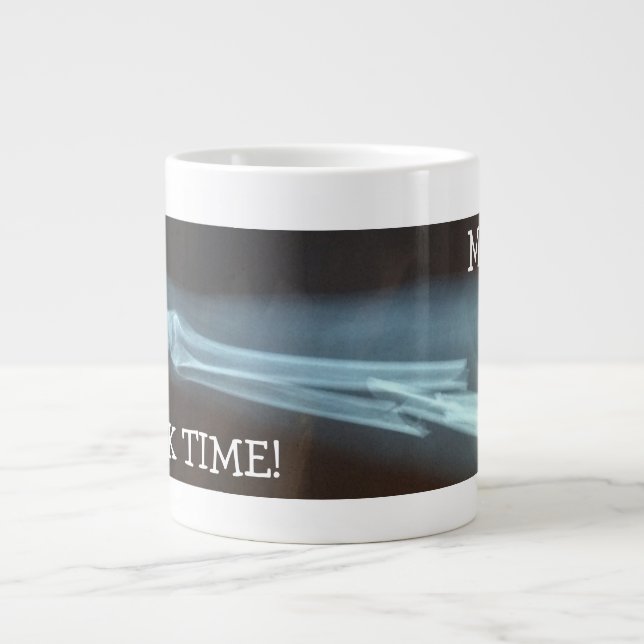 Fragmenterad radie och Ulna Xray "Break Time" Jumbo Mugg (Framsidan)