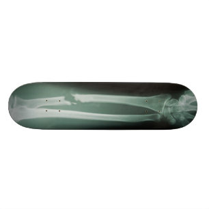 Frakturar Mini Skateboard Bräda 18,7 Cm