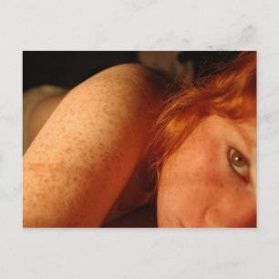 Freckles Vykort