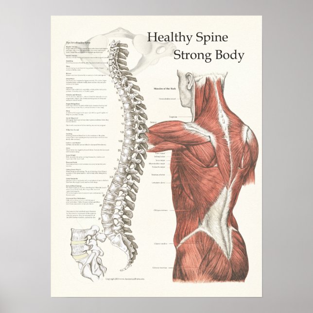 Friska ryggraden, kraftig Poster av Body Chiroprak (Framsidan)