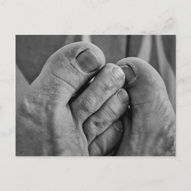 Ful fot vykort (Framsida)