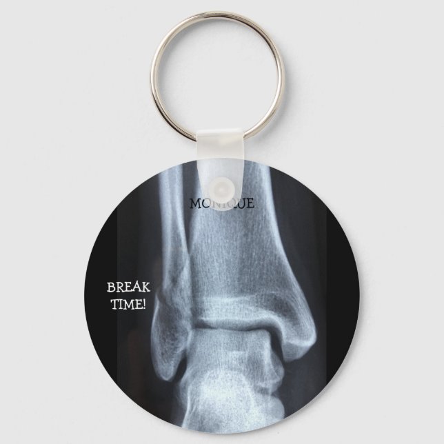 Funny Broken Fibula Xray "Break Time" Nyckelring (Framsida)