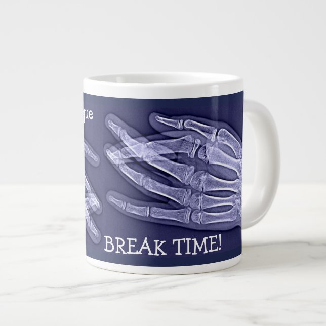 Funny Broken Finger Xray "Break Time" Jumbo Mugg (Framsida höger)