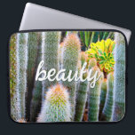 Fuzzy Grönt Cacti Succulent Photo Beauty Script Laptop Sleeve<br><div class="desc">Cacti blomstrar i den härligaste öknen villkor. Drömmen om soliga dagar och skönheten i en sommarträdgård när man användor den här fantastiska fotografiet neopren laptop sleeve. Laptop sleeve finns i tre storlekar: 15, 13 och 10 tum. Gör en underbar gåva till någon speciell! Du kan enkelt anpassa den här neoprenen...</div>