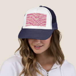 Girly Pink Blush Glitter Zebra Pattern Keps