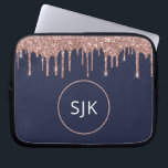 Glitter-drivrutiner för marinblå marinblått Ro Gul Laptop Fodral<br><div class="desc">Girly  Rosa - Ro Guld och marinblå Faux Glitter Drips och Gnistra Elegant Monogrammed Initialer Fodral. Fodral kan anpassas så att det omfattar ditt första och första namn.</div>